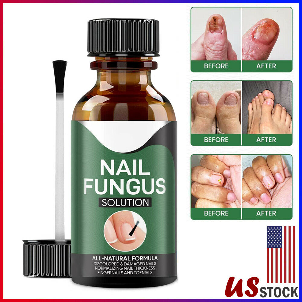 Nail Treatment & remover