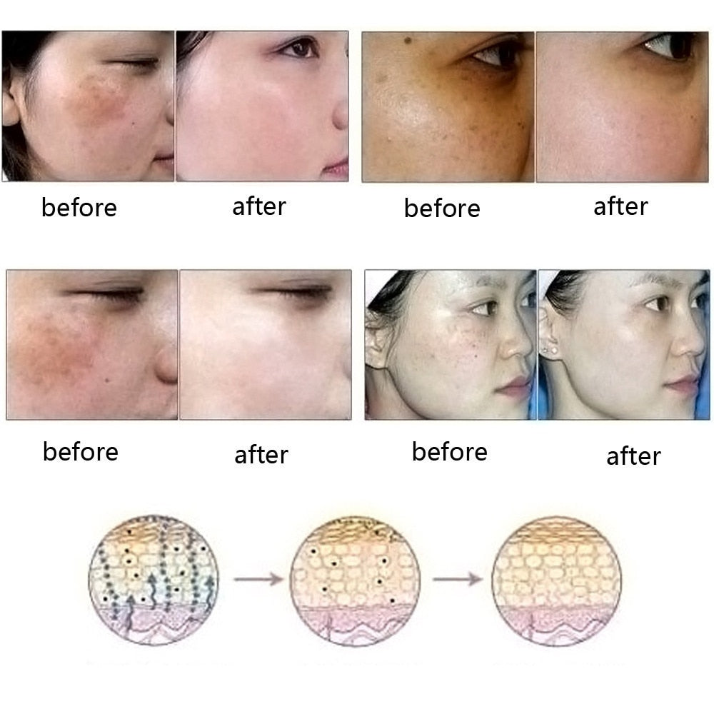 Scar Removal Essence oil