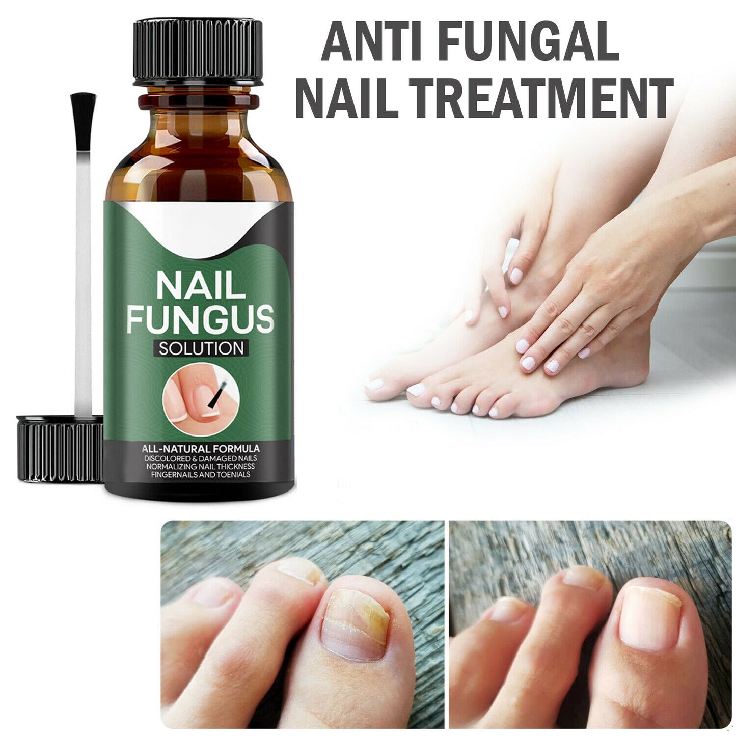 Nail Treatment & remover