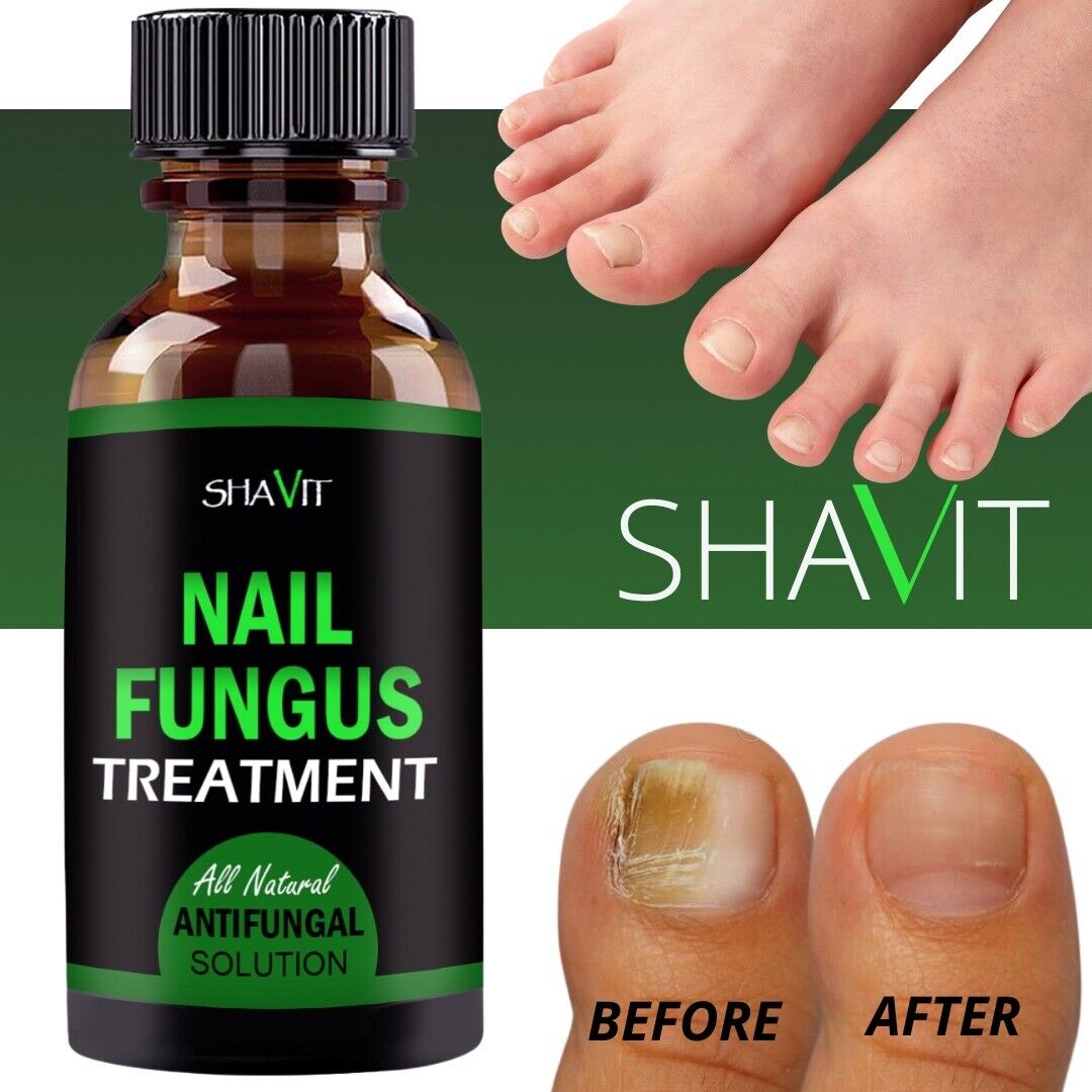 ANTI FUNGAL TREATMENT