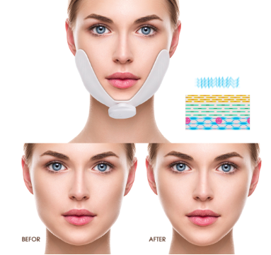 Facial Slimming Device