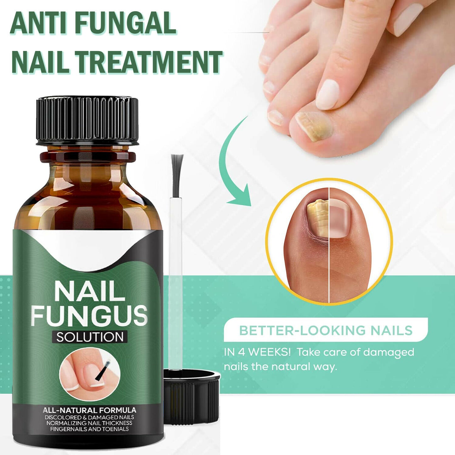 Nail Treatment & remover