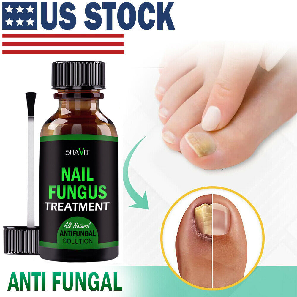 ANTI FUNGAL TREATMENT